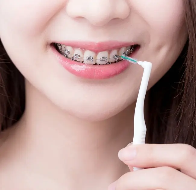 Ang Interdental Brushes ay Lumilikha ng Bagong Karanasan ng Pinong Pangangalaga sa Bibig